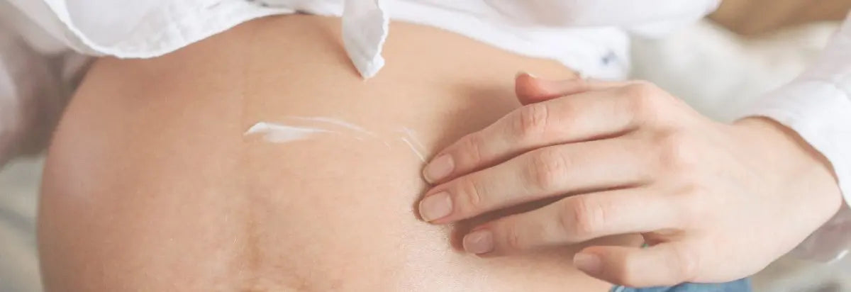 Esto le ocurre a tu piel durante el embarazo