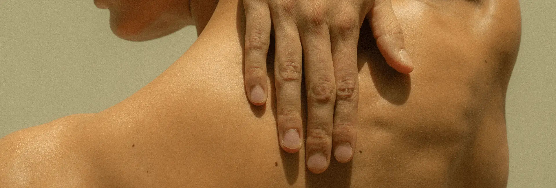 Urticaria, mis manchitas rojas impredecibles